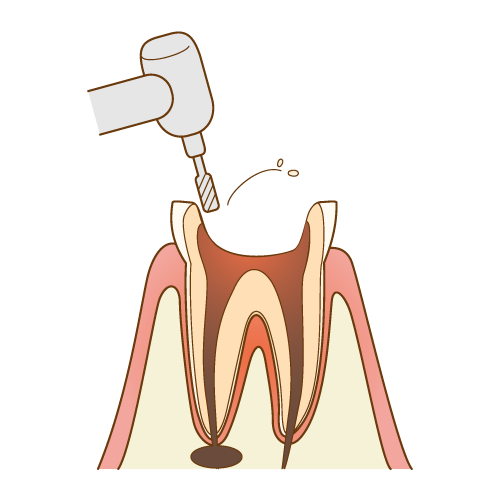 complete-recovery003