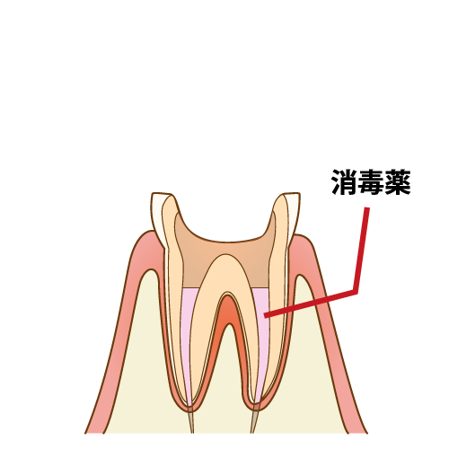 complete-recovery006_caption _FIX