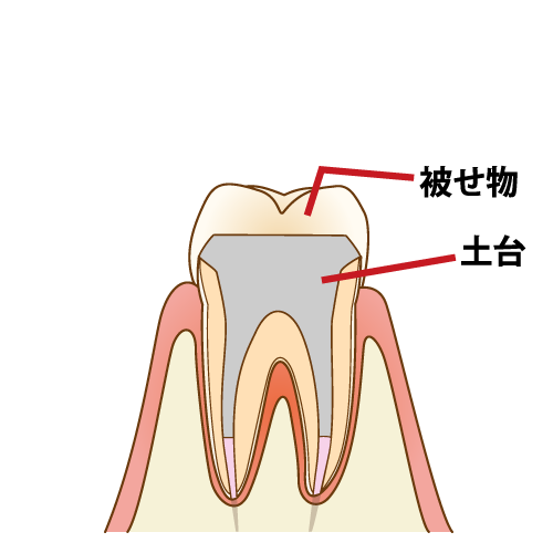 complete-recovery007_caption_FIX