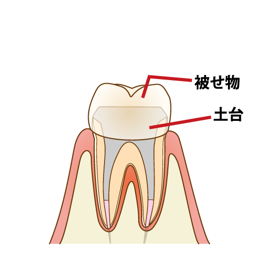 complete-recovery008_caption_FIX